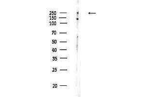 anti-Dedicator of Cytokinesis 7 (DOCK7) (N-Term) antibody