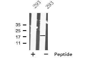 Western blot analysis IMMP1L using 293 whole cell lysates (IMMP1L antibody  (Internal Region))