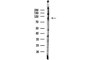 anti-Kinesin Family Member 19 (KIF19) (Internal Region) antibody