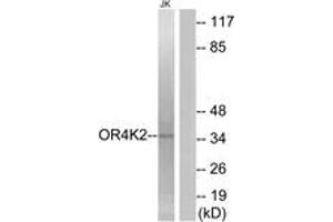 Western blot analysis of extracts from Jurkat cells, using OR4K2 Antibody. (OR4K2 antibody  (AA 265-314))