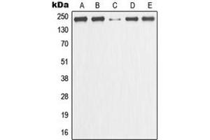 Western blot analysis of GANP expression in HeLa (A), MCF7 (B), Raw264.