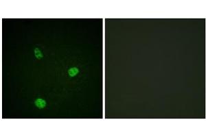 Immunofluorescence analysis of HeLa cells, using MITF (epitope around residue 180/73) antibody. (MITF antibody  (Ser73, Ser180))