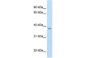 Western Blot showing ZMYND11 antibody used at a concentration of 1-2 ug/ml to detect its target protein. (ZMYND11 antibody  (Middle Region))