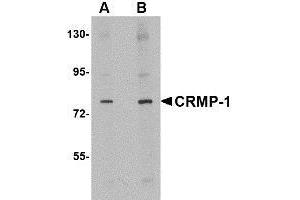 Western blot analysis of CRMP1 in rat brain tissue lysate with AP30244PU-N CRMP1 antibody at (A) 1 and (B) 2 μg/ml. (CRMP1 antibody  (N-Term))