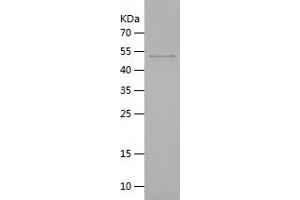 METRNL Protein (AA 46-311) (His-IF2DI Tag)