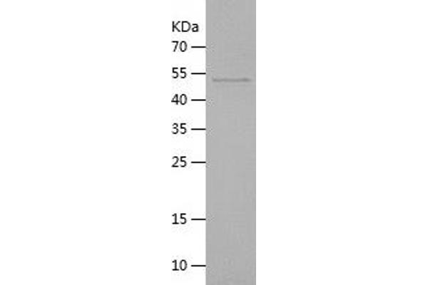 METRNL Protein (AA 46-311) (His-IF2DI Tag)