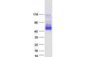 Western Blotting (WB) image for Transmembrane Protein 51 (TMEM51) (Transcript Variant 2) protein (Myc-DYKDDDDK Tag) (ABIN2733902)
