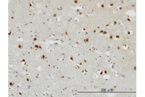 Image no. 1 for anti-Fibroblast Growth Factor 12 (FGF12) (AA 1-182) antibody (ABIN598680) (FGF12 antibody  (AA 1-182))