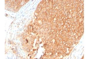 Formalin-fixed, paraffin-embedded human Pancreas stained with Topo I Rabbit Recombinant Monoclonal Antibody (TOP1MT/2883R). (Recombinant TOP1MT antibody)