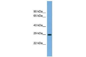RAB40C antibody used at 1 ug/ml to detect target protein. (RAB40C antibody  (N-Term))