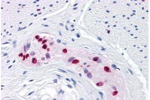 Human Colon, myenteric plexus: Formalin-Fixed, Paraffin-Embedded (FFPE) (SOX9 antibody  (AA 400-510))