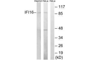 Western blot analysis of extracts from HeLa cells and HepG2 cells, using IFI16 antibody.