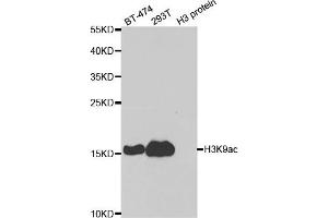 Western blot analysis of extracts of various cell lines and H3 protein expressed in E. (Histone 3 antibody  (H3K9ac))