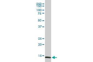 FABP4 MaxPab rabbit polyclonal antibody. (FABP4 antibody  (AA 1-132))