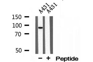 Western blot analysis of extracts of A431 cells, using TELO2 antibody.