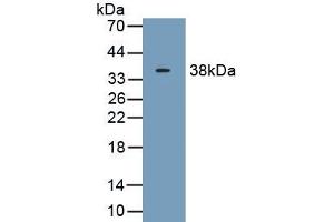 Detection of Recombinant C1qB, Human using Polyclonal Antibody to Complement Component 1, Q Subcomponent B (C1qB) (C1QB antibody  (AA 28-253))