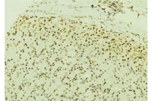 ABIN6277190 at 1/100 staining Human gastric tissue by IHC-P. (USP7 antibody  (Internal Region))