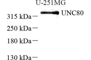 Western blot analysis of UNC80 (ABIN7076151),at dilution of 1: 2000