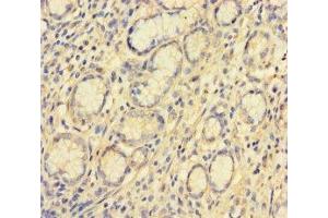 Immunohistochemistry of paraffin-embedded human stomach tissue using ABIN7175533 at dilution of 1:100 (VKORC1L1 antibody  (AA 38-91))