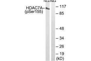 Western blot analysis of extracts from HeLa cells using HDAC7A (Phospho-Ser155) Antibody. (HDAC7 antibody  (pSer155))