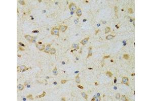 Immunohistochemistry of paraffin-embedded Rat brain using SRP19 Polyclonal Antibody at dilution of 1:100 (40x lens).