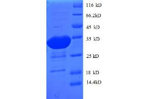 SDS-PAGE (SDS) image for Family with Sequence Similarity 5, Member B (FAM5B) (AA 2-169) protein (His-SUMO Tag) (ABIN4974090)