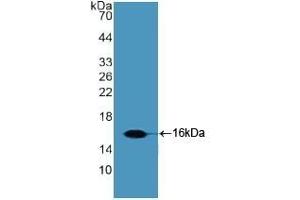 Detection of Recombinant Slit2, Human using Polyclonal Antibody to Slit Homolog 2 (Slit2) (SLIT2 antibody  (AA 1416-1528))
