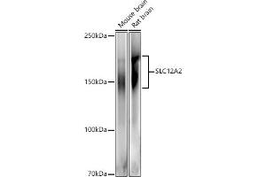 Western blot analysis of extracts of various cell lines, using SLC12 antibody (ABIN6131136, ABIN6147843, ABIN6147844 and ABIN6215366) at 1:500 dilution. (SLC12A2 antibody  (AA 120-280))