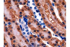 DAB staining on IHC-P; Samples: Rat Kidney Tissue (Glutathione Synthetase antibody  (AA 270-474))
