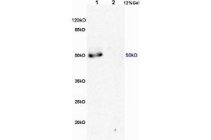 L1 human colon carcinoma lysates L2 rat brain lysates probed with Anti MSR1/CD204 Polyclonal Antibody, Unconjugated (ABIN872905) at 1:200 overnight at 4 °C. (Macrophage Scavenger Receptor 1 antibody  (AA 211-320))