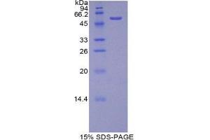 SDS-PAGE (SDS) image for Vitamin K-dependent protein C (PROC) (AA 186-437) protein (His tag,GST tag) (ABIN2123534)