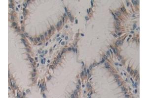 DAB staining on IHC-P; Samples: Human Stomach Tissue (CSF2RA antibody  (AA 204-360))