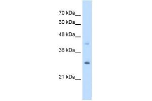 CACYBP antibody used at 5 ug/ml to detect target protein. (CACYBP antibody  (Middle Region))