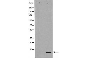 Gastrin antibody  (C-Term)