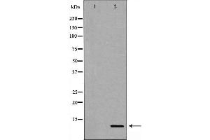 Western blot analysis of Gastrin expression in NIH/3T3 cell extract.