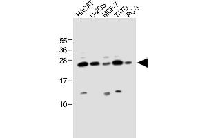All lanes : Anti-SCXA Antibody (C-term) at 1:1000 dilution Lane 1: HACAT whole cell lysate Lane 2: U-2OS whole cell lysate Lane 3: MCF-7 whole cell lysate Lane 4: T47D whole cell lysate Lane 5: PC-3 whole cell lysate Lysates/proteins at 20 μg per lane. (SCXA antibody  (C-Term))