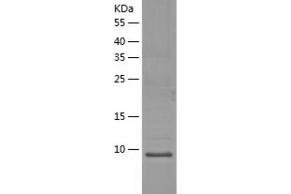 MUSTN1 Protein (AA 1-82) (His tag)