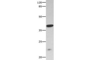 Gel: 10 % SDS-PAGE Lysate: 40 μg Mouse skeletal muscle tissue lysate Primary antibody: 1/300 dilution Secondary antibody: Goat anti Rabbit IgG - H&L (HRP) at 1/10000 dilution Exposure time: 60 seconds (CNTF Receptor alpha antibody  (AA 23-342))