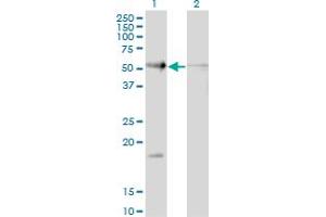 Western Blot analysis of RAD23B expression in transfected 293T cell line by RAD23B monoclonal antibody (M10), clone 3H7. (RAD23B antibody  (AA 311-409))