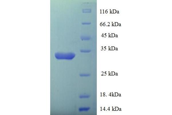 LSMD1 Protein (AA 2-173) (His-SUMO Tag)