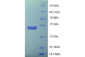 SDS-PAGE (SDS) image for LSM Domain Containing 1 (LSMD1) (AA 2-173) protein (His-SUMO Tag) (ABIN5711853)