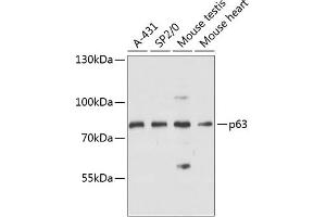 Western blot analysis of extracts of various cell lines, using p63 antibody (ABIN6133471, ABIN6149424, ABIN6149427 and ABIN6216755) at 1:3000 dilution. (p63 antibody  (AA 1-160))