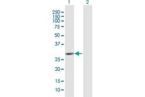 Western Blot analysis of CEMP1 expression in transfected 293T cell line by CEMP1 MaxPab polyclonal antibody. (CEMP1 antibody  (AA 1-247))