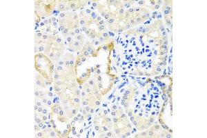 Immunohistochemistry of paraffin-embedded mouse kidney using TDGF1 antibody at dilution of 1:100 (x40 lens).