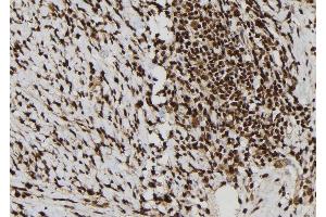 ABIN6277792 at 1/100 staining Human gastric tissue by IHC-P. (Calretinin antibody  (C-Term))