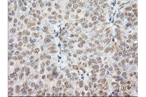 Immunohistochemical staining of paraffin-embedded Human colon tissue using anti-PDE4A mouse monoclonal antibody. (PDE4A antibody)