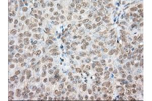 Immunohistochemical staining of paraffin-embedded Human colon tissue using anti-PDE4A mouse monoclonal antibody.