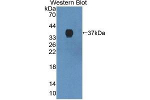 Detection of Recombinant ABCG2, Mouse using Polyclonal Antibody to ATP Binding Cassette Transporter G2 (ABCG2) (ABCG2 antibody  (AA 63-349))