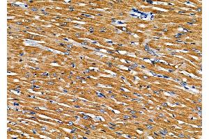 ABIN6260110 and ABIN6277936 at 1/100 staining Rat heart tissue by IHC-P. (PNPLA2 antibody  (Internal Region))