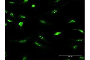 Immunofluorescence of purified MaxPab antibody to IFRD2 on HeLa cell. (IFRD2 antibody  (AA 1-442))